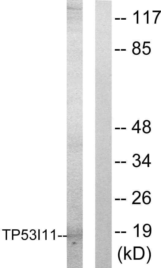 TP53I11 / PIG11 Antibody (aa71-120)