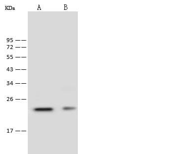 Polyclonal Rabbit anti-Mouse IGLL1 / CD179b Antibody (WB)