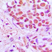 SRSF4 / SFRS4 Antibody (Internal)