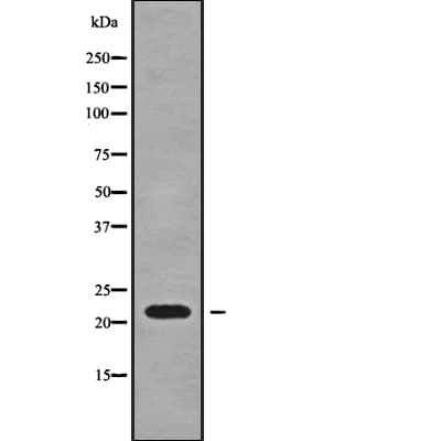 Polyclonal Rabbit anti-Human SFT2D3 Antibody (IHC, WB)