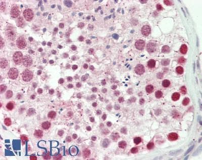 MYST2 / HBO1 Antibody (aa125-175)