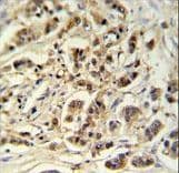 Polyclonal Rabbit anti-Human METT11D1 Antibody (aa88-116, IHC, WB)