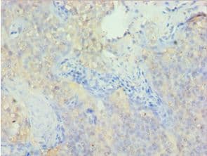 Polyclonal Rabbit anti-Human PDLIM1 Antibody (aa1-329, IHC, WB)