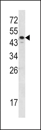 SERPINA7 / TBG Antibody (aa354-383)