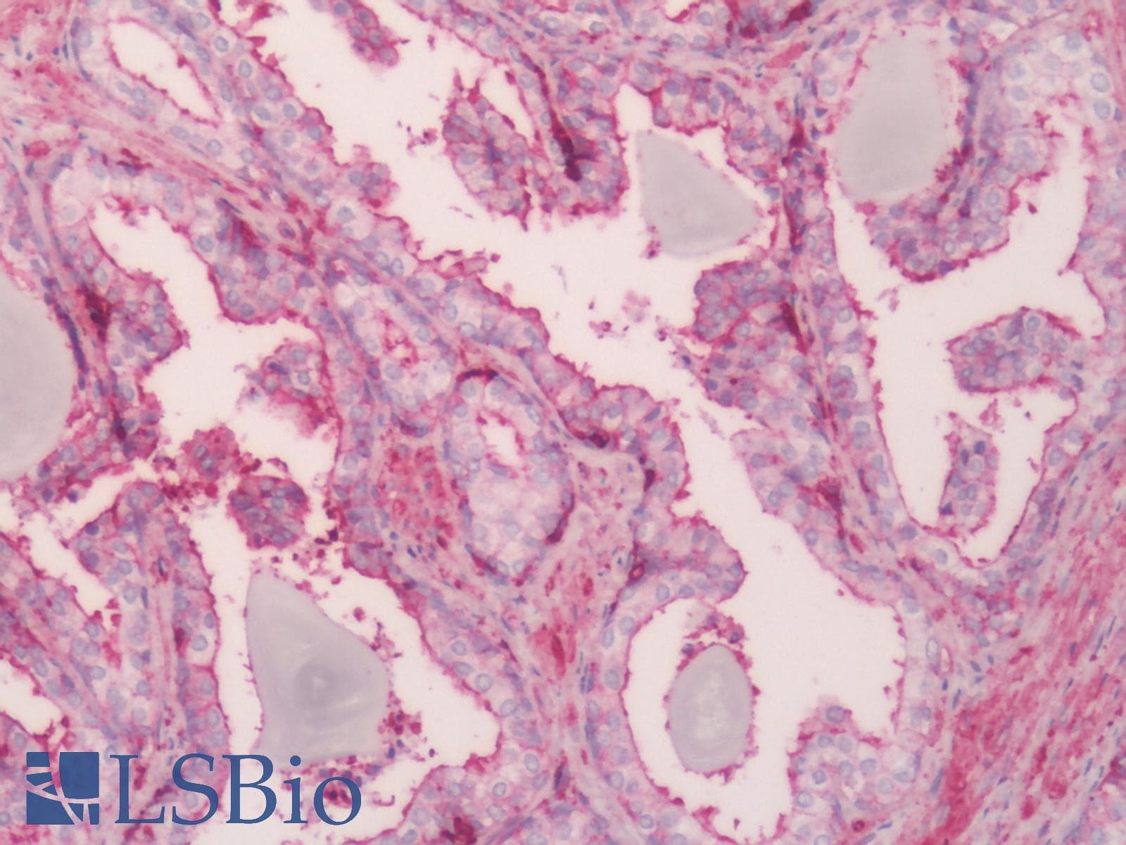 IHC-plus™ Monoclonal Mouse anti-Human ACTB / Beta Actin Antibody (clone 4C2, N-Terminus, IHC, IF, WB)
