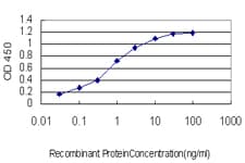 IHC-plus™ ACAA2 Antibody (clone 5C4)
