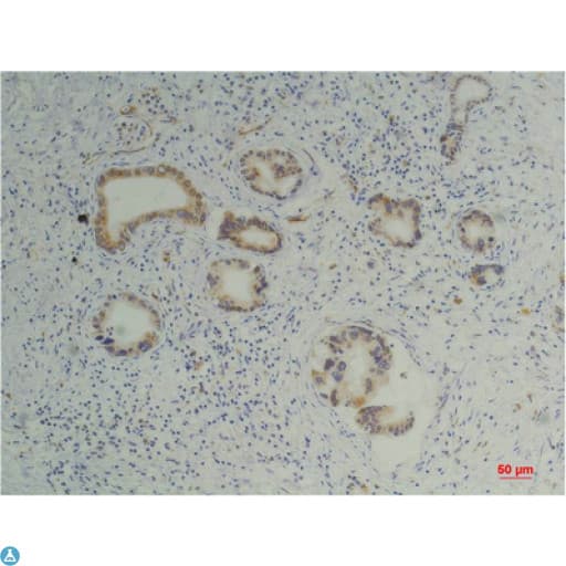 Monoclonal Mouse anti-Human PPIB / Cyclophilin B Antibody (IHC, WB)