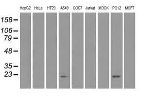 CRYAB / Alpha B Crystallin Antibody (clone OTI6A9)