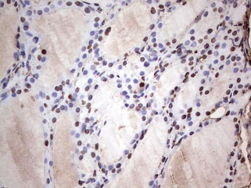 Monoclonal Mouse anti-Human SAE1 Antibody (clone OTI6B11, IHC, WB)