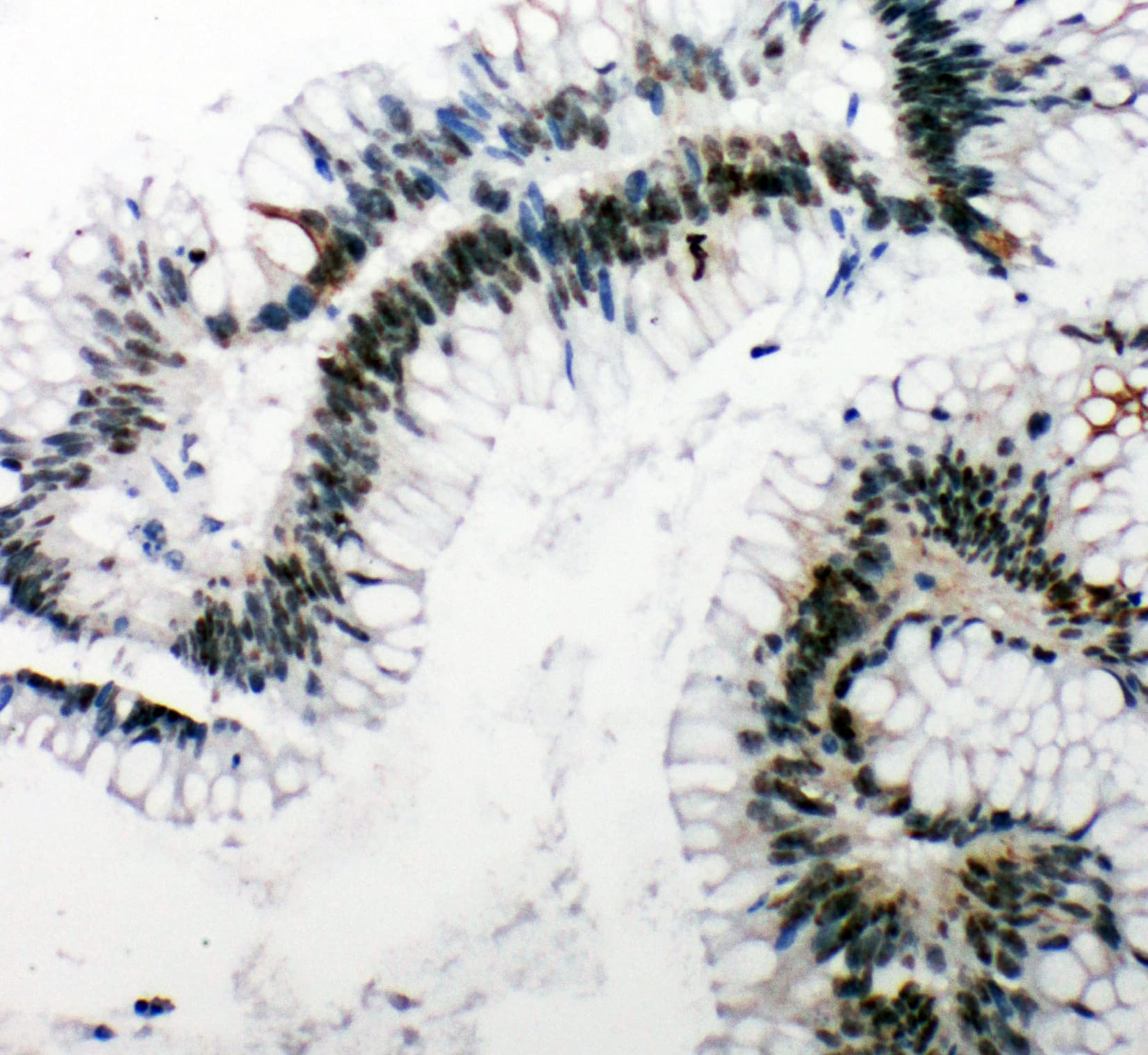 TP53BP1 / 53BP1 Antibody (aa1955-1972)