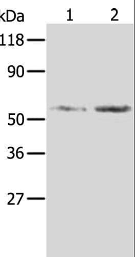 AKR1B1 / Aldose Reductase Antibody