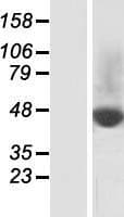 SLC37A2 Protein (Over-Expression Lysate Myc-DDK (Flag))