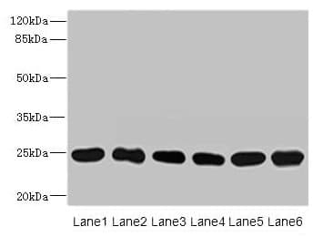 Polyclonal Rabbit anti-Human FKBP14 Antibody