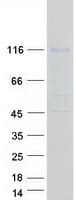 Human PML Protein (Recombinant Myc-DDK (Flag))