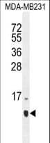 HCFC1R1 / HPIP Antibody (aa1-30)