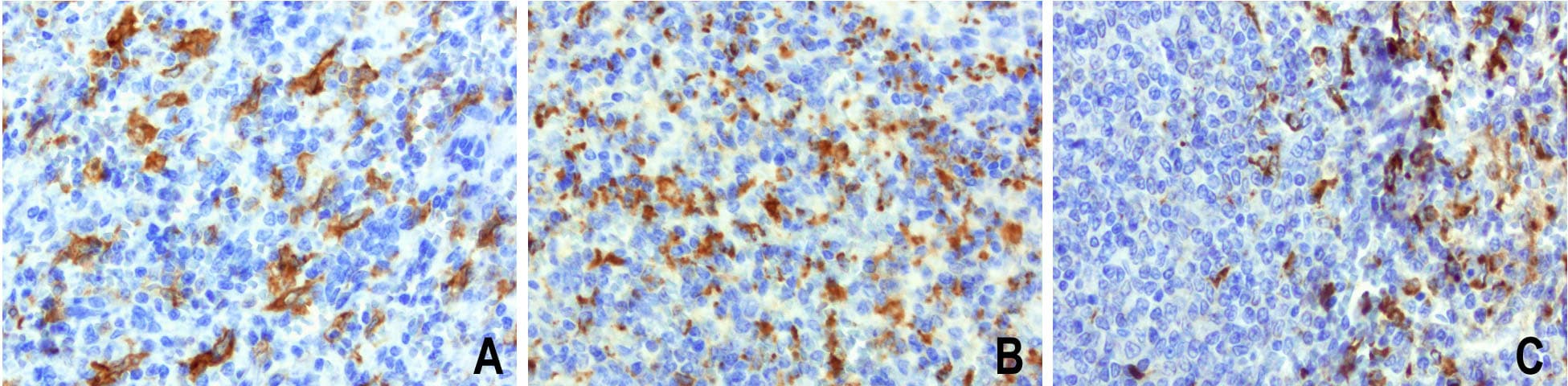 CD68 Antibody (aa22-319, clone UMAB150, Carrier-free)