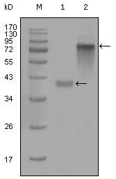 KRT19 / CK19 / Cytokeratin 19 Antibody (clone 9H8G6)