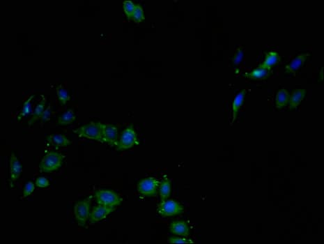 Polyclonal Rabbit anti-Human CTSL / Cathepsin L Antibody (IHC, IF)