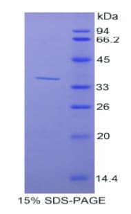 Human CUTC Protein (Recombinant His-S)