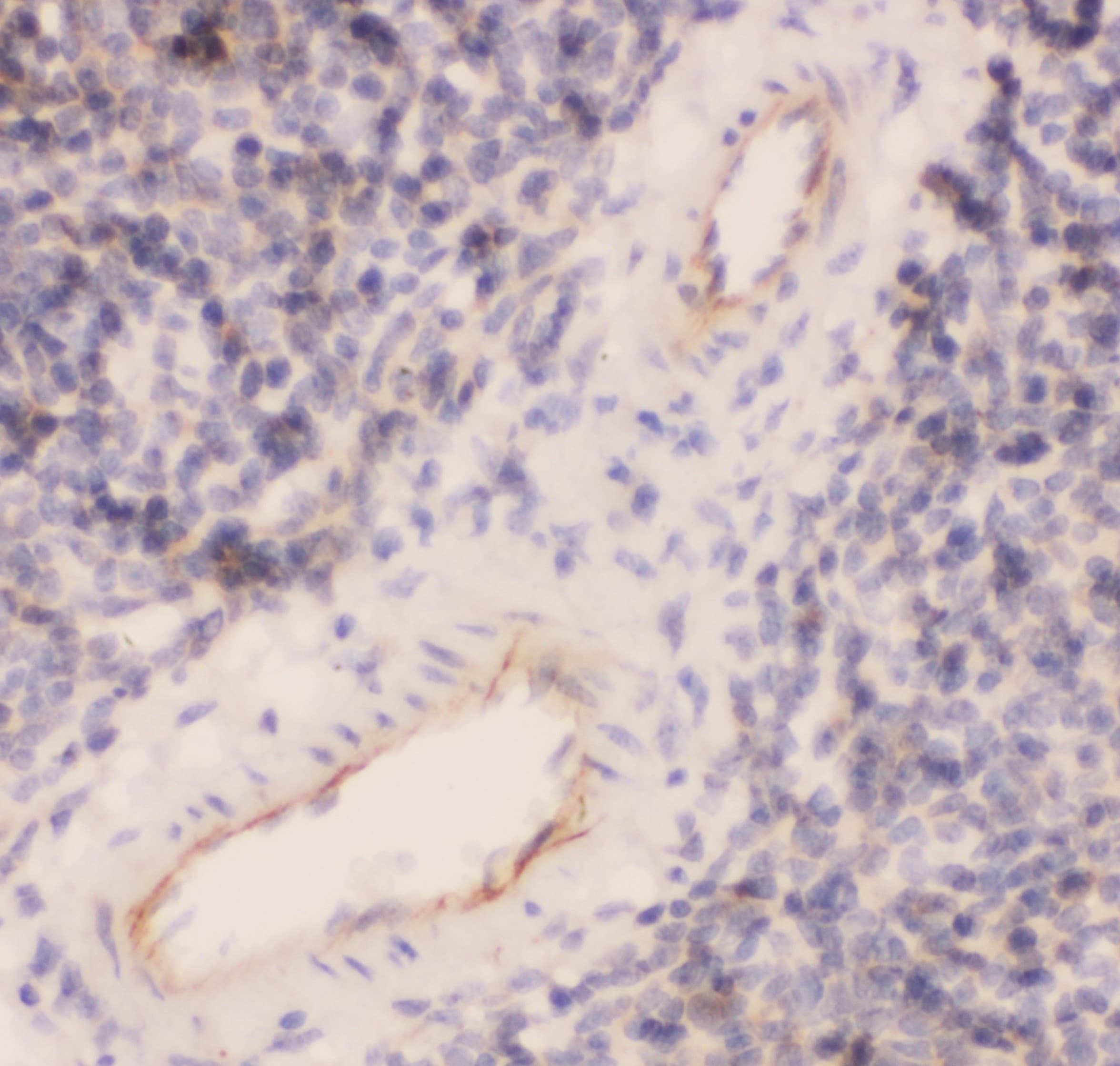 Polyclonal Rabbit anti-Human PECAM-1 / CD31 Antibody (aa28-382, IHC, WB)