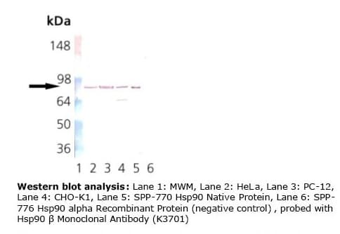 HSP90 / Heat Shock Protein 90 Antibody (clone K3701)
