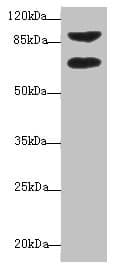 Polyclonal Rabbit anti-Human DTX2 Antibody (IHC, WB)