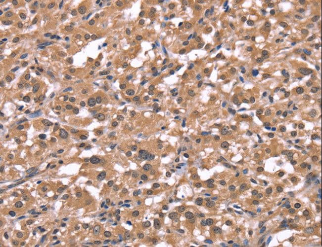 Polyclonal Rabbit anti-Human HRH1 / Histamine H1 Receptor Antibody (IHC, WB)