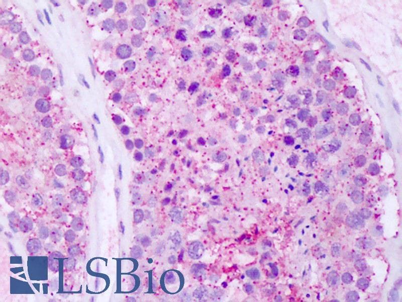 IHC-plus™ GPRC5A / RAI3 Antibody (C-Terminus)