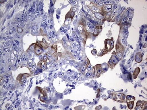 KRT19 / CK19 / Cytokeratin 19 Antibody (aa240-390, clone OTI8D1)