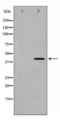 Polyclonal Rabbit anti-Human SIRT2 / Sirtuin 2 Antibody (WB)