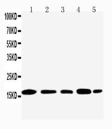 TIA-1 Antibody (aa98-110)