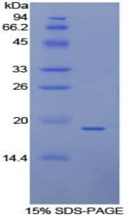 Human ANXA4 / Annexin IV Protein (Recombinant His)