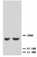 TIMP2 Antibody (C-Terminus)