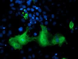 ERBB2 / HER2 Antibody (aa676-1255, clone OTI4G10, Carrier-free)