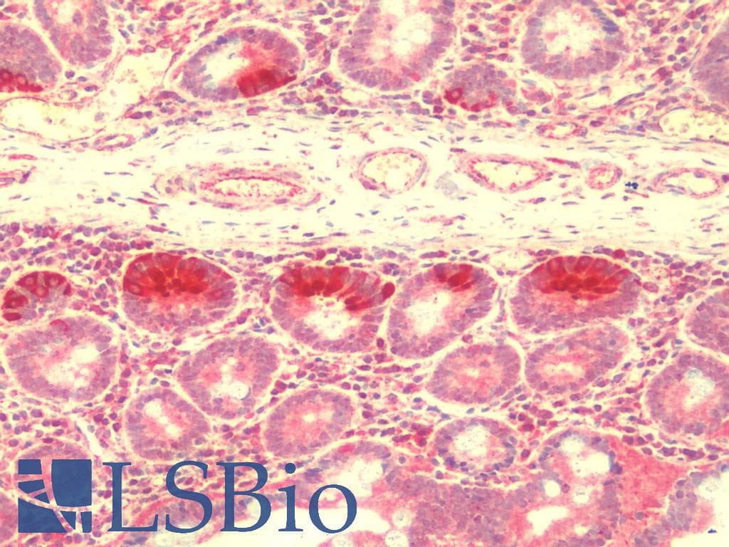 IHC-plus™ Polyclonal Rabbit anti-Human ZBTB3 Antibody (IHC, IF, WB)