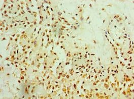 MTDH / Metadherin Antibody (aa1-260)