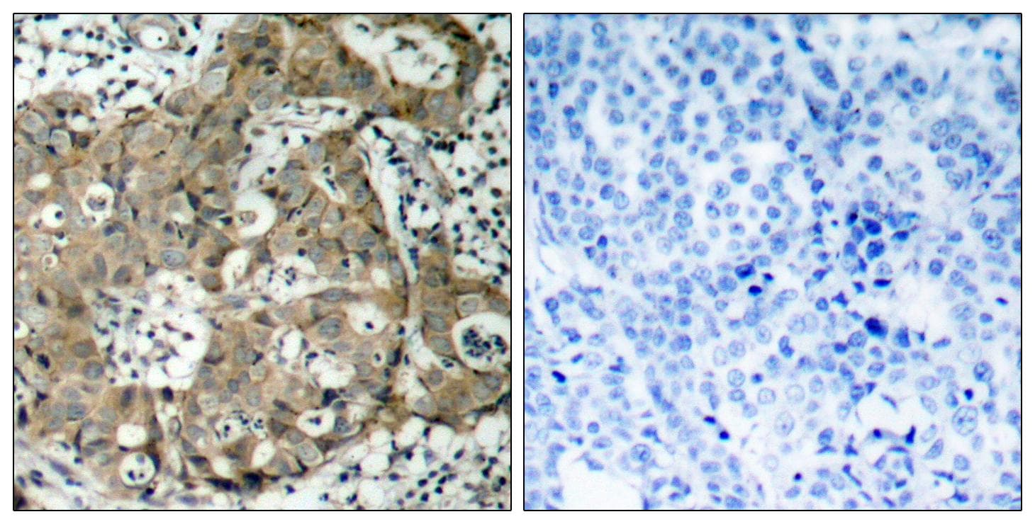 Polyclonal Rabbit anti-Human FOXO1 / FKHR Antibody (p319, IHC, WB)