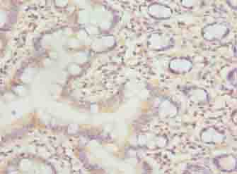 C7orf34 Antibody