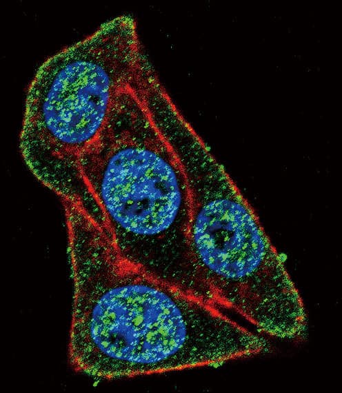 Polyclonal Rabbit anti-Human PAX6 Antibody (aa352-380, IHC, IF, WB)