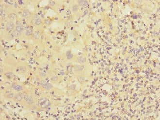 CSRP2 Antibody (aa1-193)