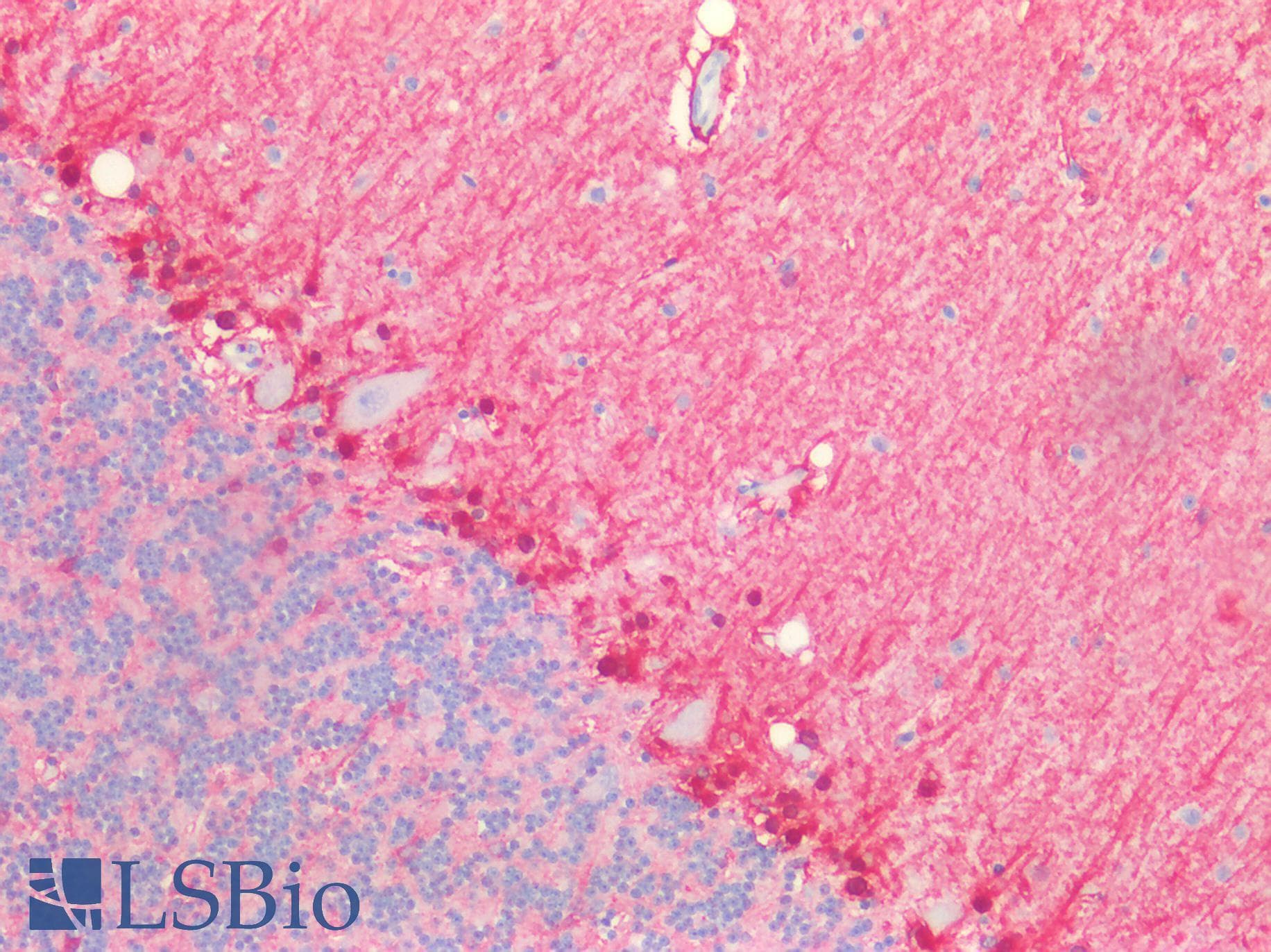 PathPlus™ ALDH1A1 / ALDH1 Antibody