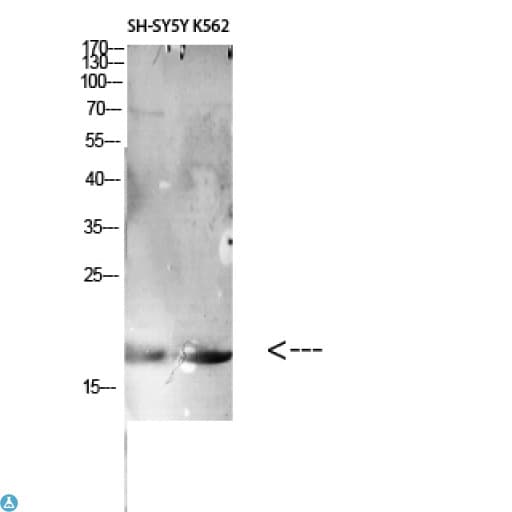 Polyclonal Rabbit anti-Human LAIR2 / CD306 Antibody (WB)