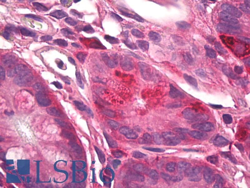 IHC-plus™ Polyclonal Rabbit anti-Human MDK / Midkine Antibody (IHC, WB)