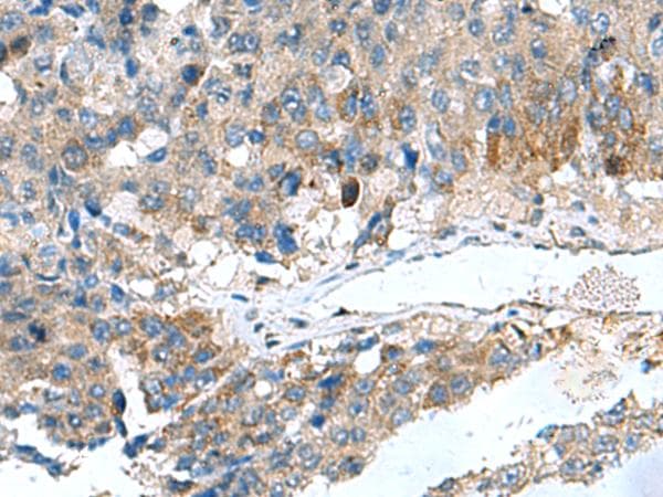 HSD11B1 / HSD11B Antibody