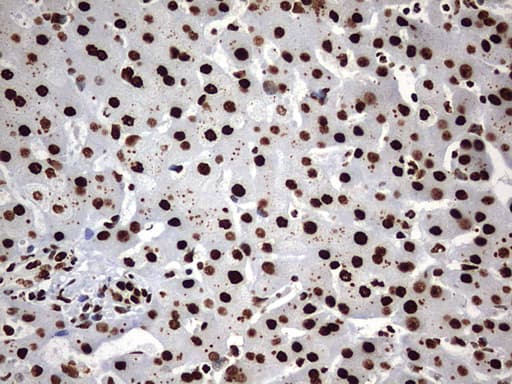 Monoclonal Mouse anti-Human HNRPM / HNRNPM Antibody (clone OTI1F6, aa1-261, IHC, WB)