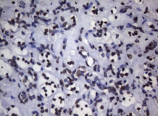 BCL6 Antibody (aa1-300, clone OTI1C3, Carrier-free)