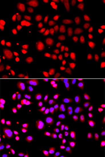 UBXD9 / ASPL Antibody (aa284-553)