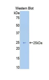 MKI67 / Ki67 Antibody (aa3088-3235, PE)