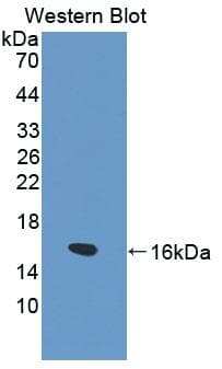 FABP1 / L-FABP Antibody (aa1-127)