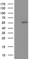 TP53 / p53 Antibody (clone OTI3A6)